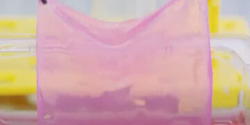 Máquina cria pele para pacientes com queimadura